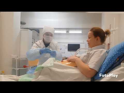 Видео: Замена калоприемника, уход за колостомой, адаптация пациента к жизни с колостомой.  Часть III 😷