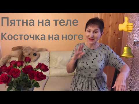 Видео: 🟢Косточки на ногах 🟢Пятна на теле 🟢Избавляемся !!!