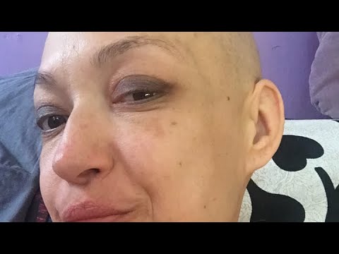 Видео: Как я узнала что у меня рак языка.
