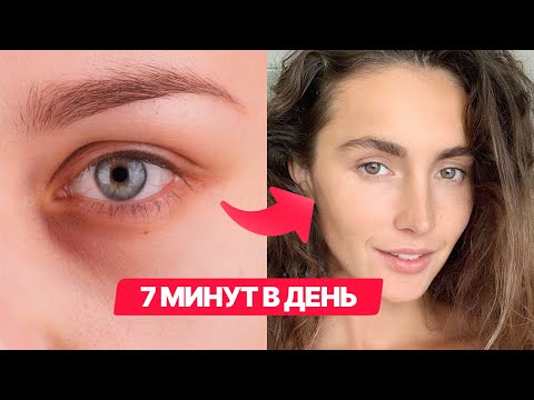 Видео: Как убрать синяки под глазами? 5 упражнений против синяков под глазами