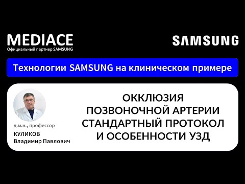 Видео: Окклюзия позвоночной артерии. Стандартный протокол и особенности УЗД на клиническом примере