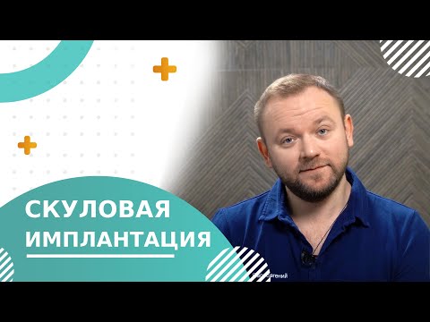 Видео: 🦷 Скуловая имплантация зубов: преимущества и особенности установки. Скуловая имплантация зубов. 18+