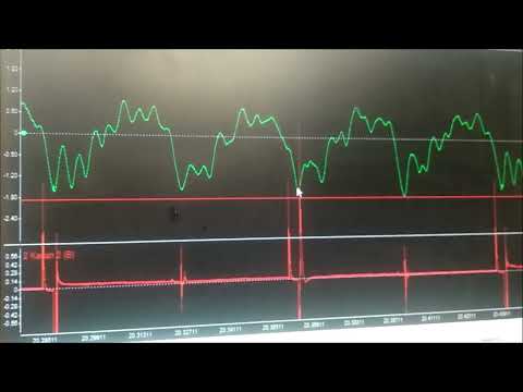Видео: Ларгус проверка осциллографом и датчиком разряжения. Плавающие обороты лада Ларгус 