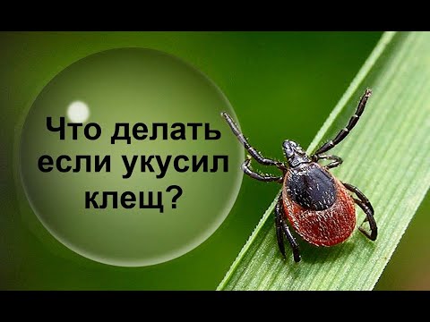 Видео: Что делать при укусе клеща? Алгоритм действий!