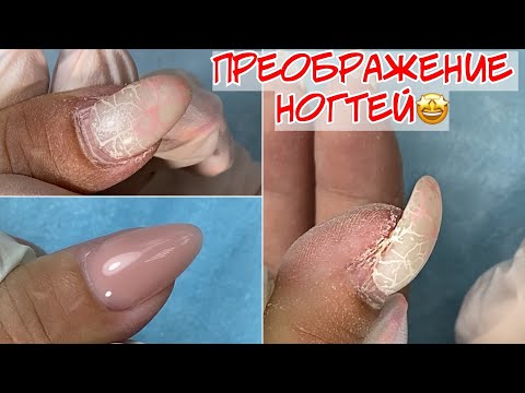 Видео: Преображение после травмы ногтя 🤕 Коррекция ногтей гелем 😍