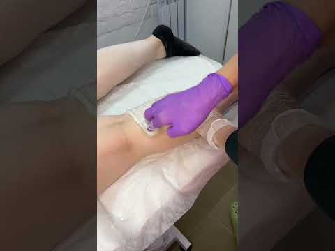 Видео: Шугаринг ног сделать дома. Сделать шугаринг самому себе.