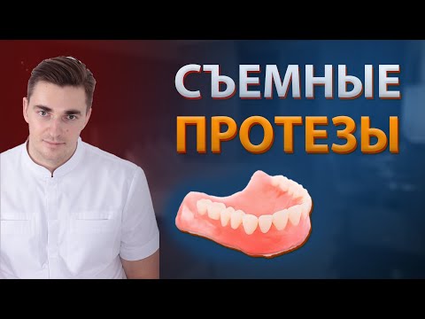 Видео: СЪЕМНЫЕ зубные ПРОТЕЗЫ | мифы, плюсы и минусы