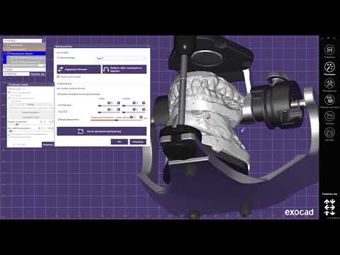 Видео: Гипсовка в виртуальный артикулятор с помощью функции "позиция скана"