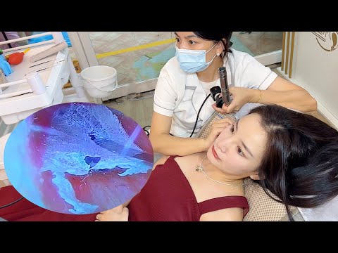 Видео: Китайская методика ASMR визуального ковыряния в ушах стабильна, чистка ушных каналов