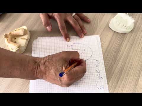 Видео: Проведение функциональных проб по Гербста  на нижней челюсти- 1 часть