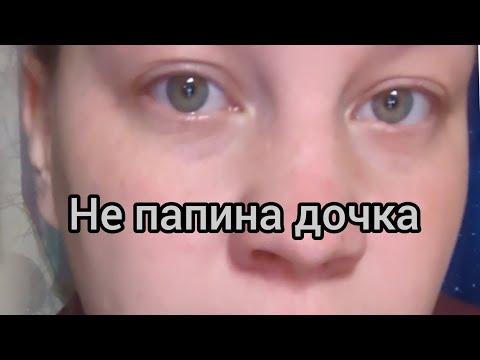 Видео: Страх проявленности. Ребенок, который не умеет за себя заступаться 