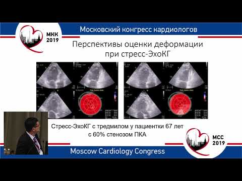 Видео: Алехин М.Н. Новейшие технологии в эхокардиографии в оптимизации лечения пациента с ИБС | Ишемия, 3д
