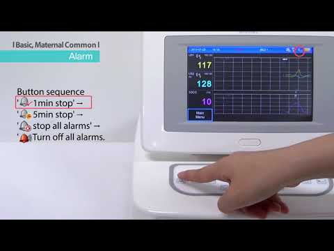 Видео: Монитор фетальный FetalXP производства Bionet, Южная Корея
