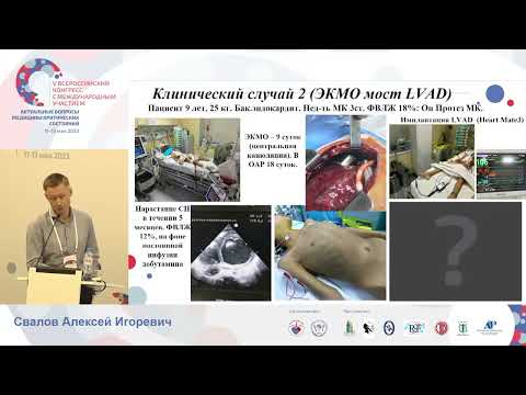 Видео: Исходный стаус и ЭКМО детей в кардиохирургии Свалов А.И.