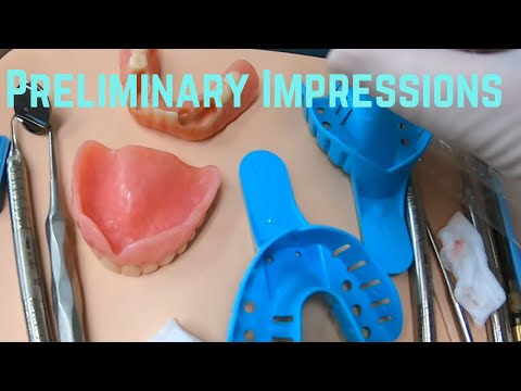 Видео: Предварительные оттиски для верхнего полного съемного протеза и нижнего частичного съемного проте...