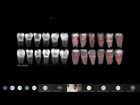 Видео: Вебинар Эндодонтия без стресса