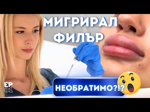 Видео: МИГРИРАЛ ФИЛЪР 🤯- Възможно ли е да възвърнем естествените си устни след това?ЗДРАВАВ и КРАСИВА КОЖА