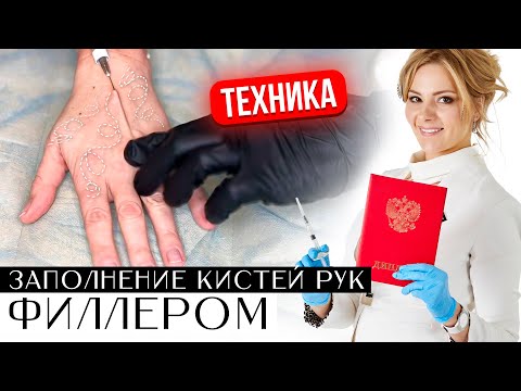Видео: Заполнение кистей рук филлером. Техника. Восстановление объема и качества кожи кистей рук.
