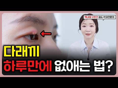 Видео: Как быстро вылечить ячмень. Офтальмолог с 17-летним стажем раскрывает секрет.