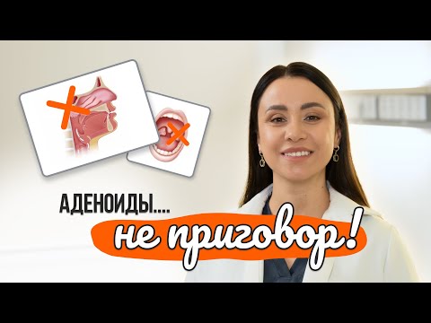 Видео: Аденоиды у ребёнка. Как лечат аденоиды в 2025 году. Советы от Лор-Мамы