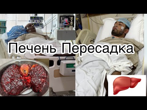 Видео: Пересадка Печень В Индии| Hindistonda jigar transplantatsiyasi| Лечение в Индии🇮🇳 Узбекистан 🇺🇿