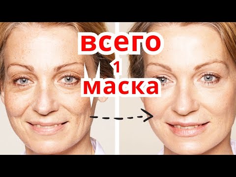 Видео: Сильная Маска с СОДОЙ против МОРЩИН  Моментальный эффект Омоложения