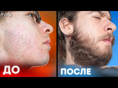 Видео: В 17 ЛЕТ ОТРАСТИЛ БОРОДУ ВИКИНГА С ПОМОЩЬЮ...