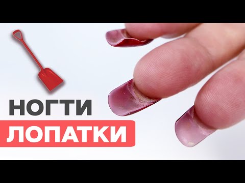 Видео: НЕ делай эти ОШИБКИ верхних форм | Ступеньки