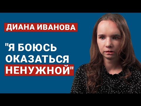 Видео: ДИАНА ИВАНОВА. ЧТО ИЗМЕНИЛОСЬ? Год после пластики. Хирургия, которая дарит новую жизнь