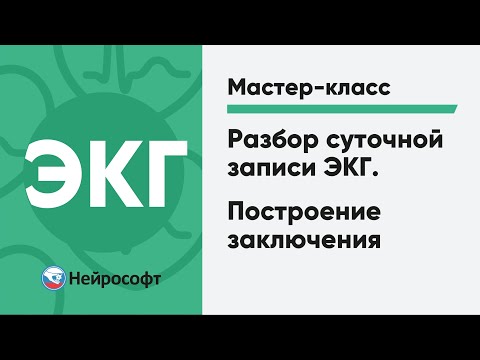 Видео: Разбор суточной записи ЭКГ. Построение заключения | Мастер-класс