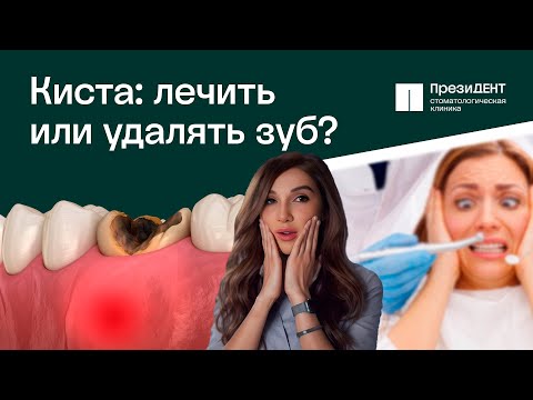 Видео: 🦷 Что делать, если появилась киста зуба - лечить или удалять? Что делать если киста зуба.