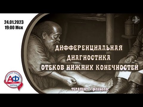 Видео: Дифференциальная диагностика отеков нижних конечностей (врачебная версия)