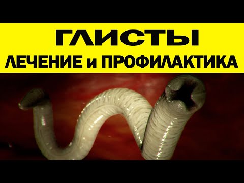 Видео: АНАЛИЗЫ  НЕ РАБОТАЮТ!   СИМПТОМЫ, ПРОФИЛАКТИКА, ЛЕЧЕНИЕ от глистов!   всё в одном видео !!!