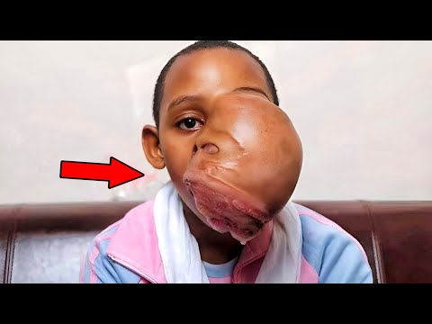 Видео: 9 человек, которые рождаются лишь раз в тысячу лет.