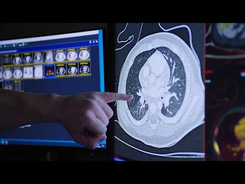 Видео: Как КТ с подсчетом фотонов улучшает доступ к передовым методам медицинской визуализации