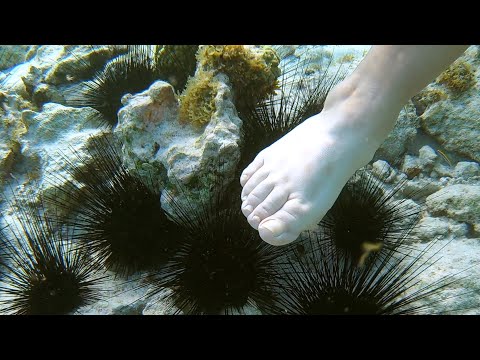 Видео: Что будет если наступить на морского ежа?