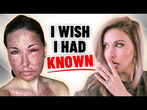 Видео: Фракционный CO2-лазер: 20 вопросов, которые вам НУЖНО ЗАДАТЬ!