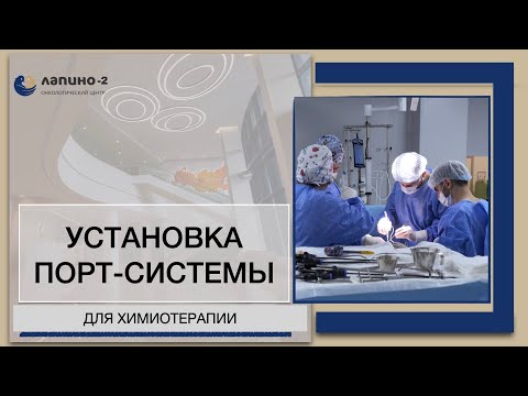 Видео: Порт-система для химиотерапии.  Зачем и кому следует ставить?