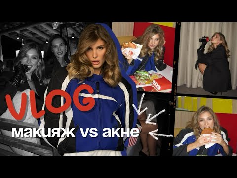 Видео: ВЛОГ / лечение кожи от акне, как сделать так, чтобы макияж НЕ портил кожу, food blog