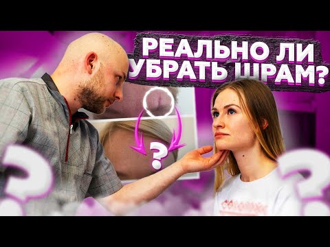 Видео: КАК УБРАТЬ ШРАМЫ И РУБЦЫ ОТ ПРЫЩЕЙ? ЖИВАЯ КОНСУЛЬТАЦИЯ С КОСМЕТОЛОГОМ КИРИЛЛОМ НОВИКОВЫМ