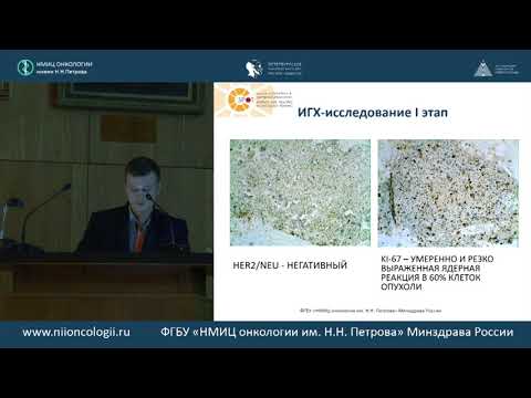 Видео: Плеоморфная саркома молочной железы