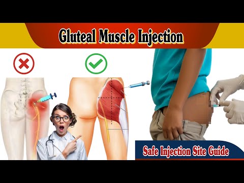 Видео: Как делать инъекцию в ягодичную мышцу | Пошаговое руководство для медсестер #инъекция