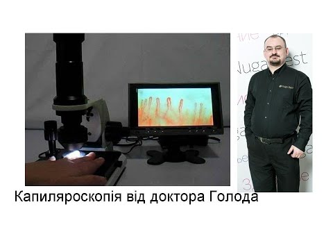 Видео: Капіляроскопія від доктора Голода