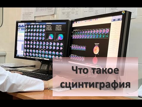 Видео: Что такое сцинтиграфия и опасна ли она для здоровья?