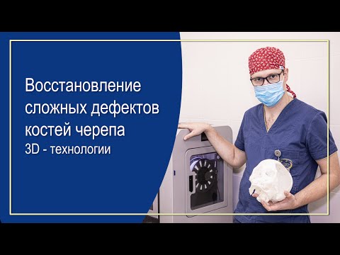 Видео: Нейрореабилитация: восстановление сложных дефектов костей черепа. 3D - технологии
