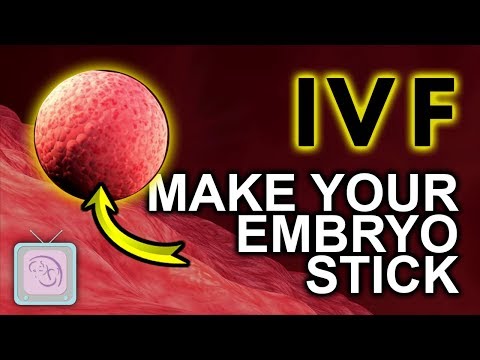 Видео: ЭКО Почему эмбрионы не приживаются (и что с этим можно сделать)
