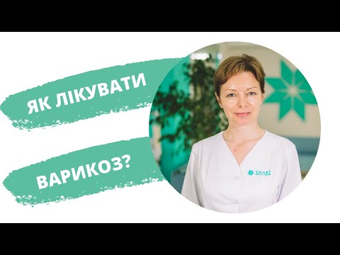 Видео: Як лікувати варикоз?