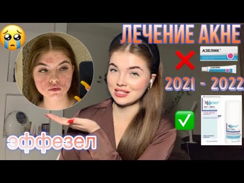 Видео: КАК Я ВЫЛЕЧИЛА КОЖУ ОТ АКНЕ | СИЛЬНЫХ ПРЫЩЕЙ | ЭФФЕЗЕЛ | МОЯ ИСТОРИЯ И ОШИБКИ