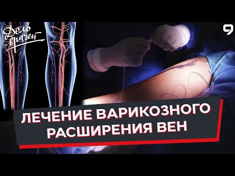Видео: Программа "Дело врачей". Варикозное расширение вен. Флебэктомия