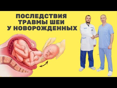 Видео: Родовые травмы шейного отдела позвоночника. Причины и последствия.
